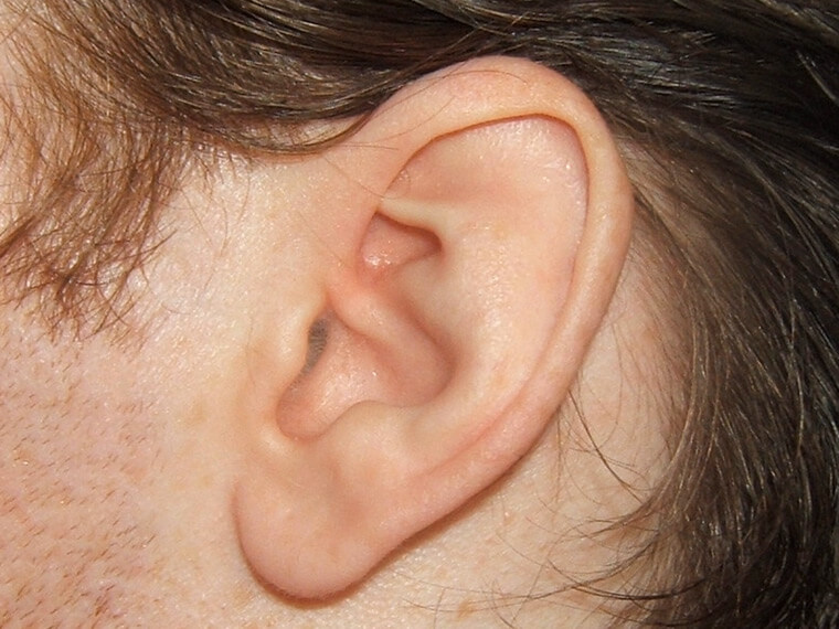 Ucho męskie bez zmian łuszczycowych